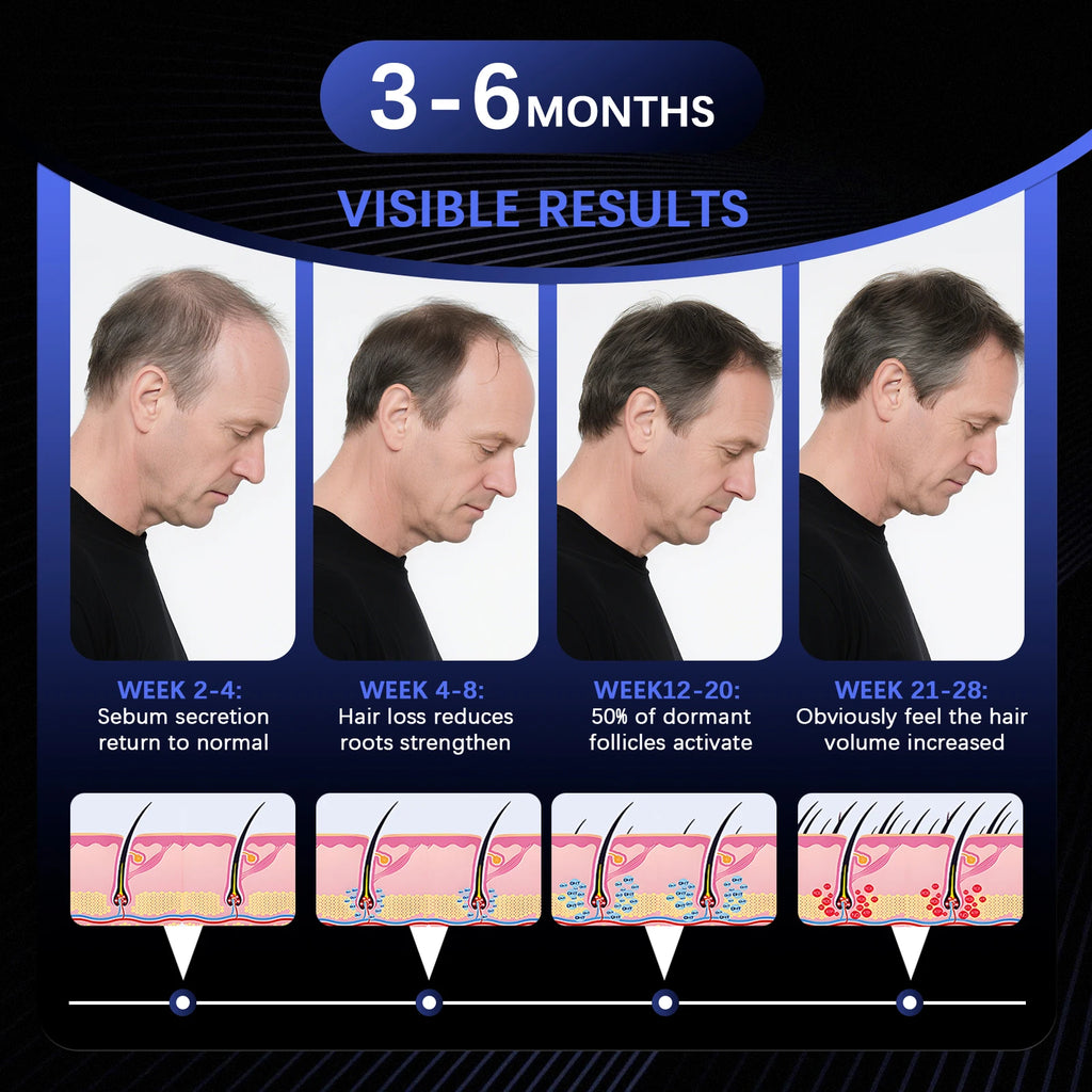 236 Laser Diodes Red Light Therapy Hair Growth Cap Anti Hair Loss Treatment Helmet for Men Women Professional Hair Regrowth Device for Thinning Hair 650nm Red 460nm Blue Light Anti-inflammatory Scalp Phototherapy Device USB R