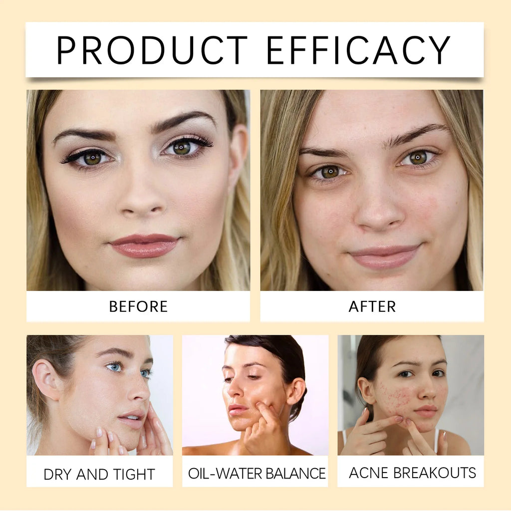 Centella Lightweight Cleansing Oil,Moisturizing Makeup Remover Enriched With Tocopherol,Cleansing&Formulated Remove Daily Makeup