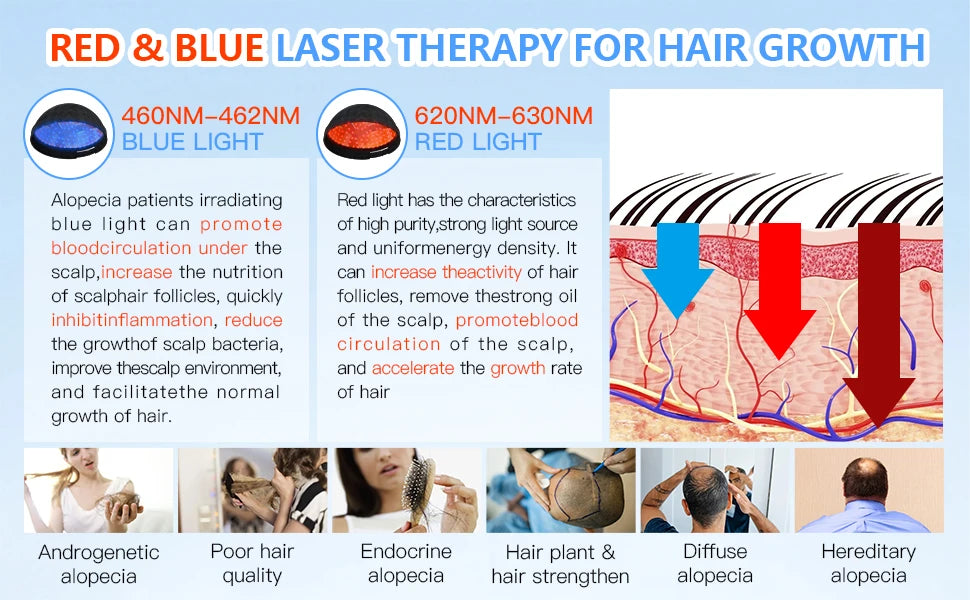 236 Laser Diodes Red Light Therapy Hair Growth Cap Anti Hair Loss Treatment Helmet for Men Women Professional Hair Regrowth Device for Thinning Hair 650nm Red 460nm Blue Light Anti-inflammatory Scalp Phototherapy Device USB R