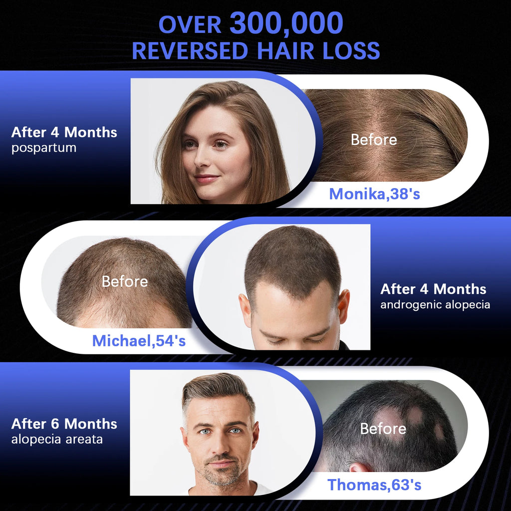 236 Laser Diodes Red Light Therapy Hair Growth Cap Anti Hair Loss Treatment Helmet for Men Women Professional Hair Regrowth Device for Thinning Hair 650nm Red 460nm Blue Light Anti-inflammatory Scalp Phototherapy Device USB R